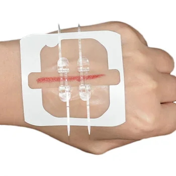 Zippered Rane Neboleč Šivanje Lepilo za Zapiranje Ran Band Aid Hitro Šivanje Zadrge Band-Aid Zunanji Prenosni Šivanje-brezplačno Band-Aid